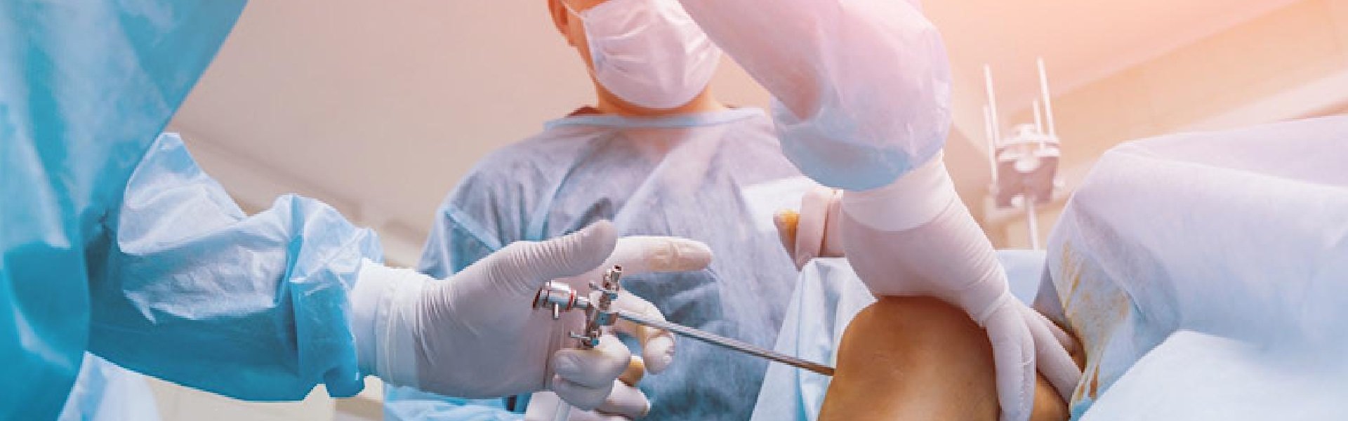 arthroscopy implants