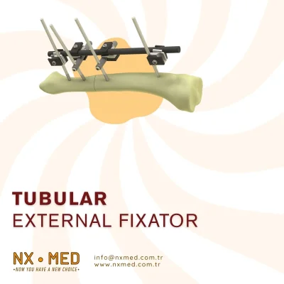 TUBULAR EXTERNAL FIXATORS