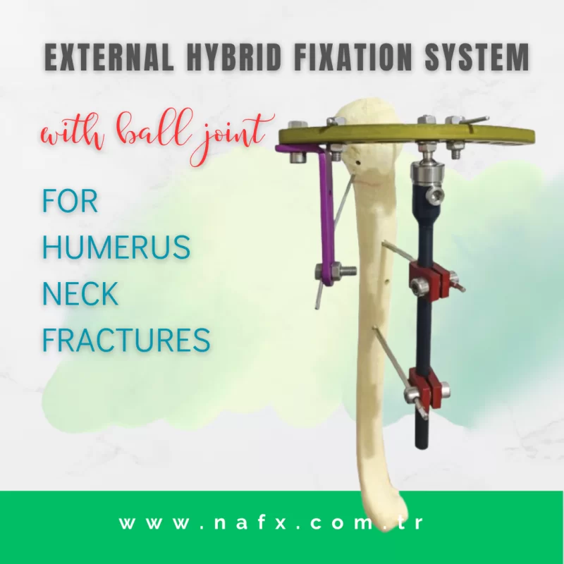 Humerus Proximal Hybrid Fixator